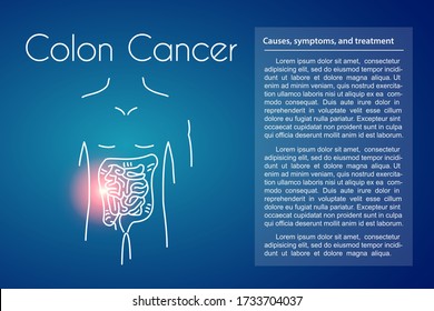 Colon Cancer Linear Icon On Blue Background. Vector Illustration Of Young Man With Red Spot On His Tummy Suffers From Colorectal Cancer. Design For Medicine Or Therapy For Bowel Cancer Or Colonoscopy.