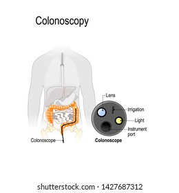 colonoscopy in the colon. Silhouette of the man with the colon and endoscope. close-up instruments of a colonoscope. Vector illustration for biological, medical and science use