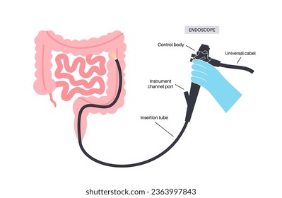 Colonoscopy is a minimally invasive procedure. Examination and treatment of the large intestine. Disorder of the colon, polyps, inflammation or swelling of bowel. Gastrointestinal disorder flat vector