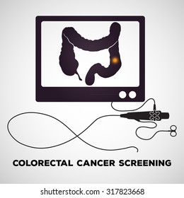 Colonoscopy Procedure Used For Screening Colon Diseases