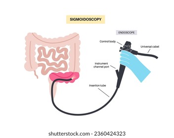 Colonoscopy and sigmoidoscopy test. Examination and treatment of the large intestine. Disorder of the colon, inflammatory bowel disease, constipation or incontinence. Gastrointestinal medical vector