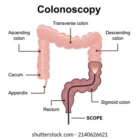 Colonoscopy technology concept with rendering endoscope inside of intestine. Medical diagram of colon with anatomical terms. Vector illustration