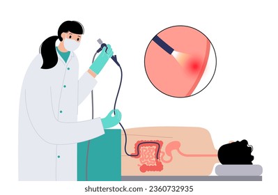 Colonoscopy treatment, familial adenomatous polyposis. Examination and diagnosis of the large intestine. FAP medical examination, bowel disease symptoms. Gastrointestinal disorder anatomical vector