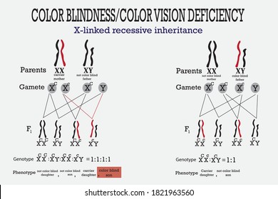 Color blindness genetics on X chromosome. X-linked gene  