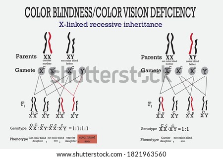 Color blindness genetics on X chromosome. X-linked gene  
