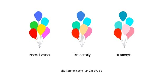 Color blindness infographic. Human vision deficiency concept. Difference between colors, brightness and intensity of shades. Tritanopia, tritanomaly and normal vision flat vector illustration