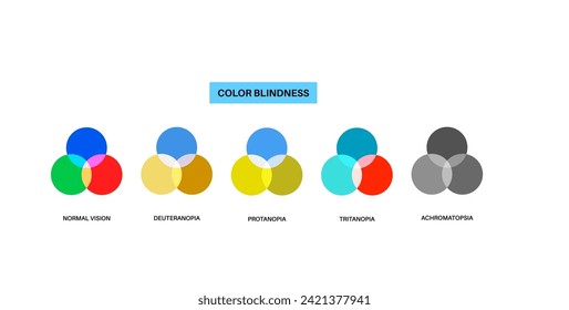 Color blindness infographic. Vision deficiency concept. Difference between colors. Deuteranomaly deuteranopia and protanomaly. Protanopia, tritanopia and tritanomaly. Achromatopsia vector illustration