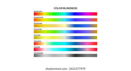 Color blindness infographic. Vision deficiency concept. Difference between colors. Deuteranomaly deuteranopia and protanomaly. Protanopia, tritanopia and tritanomaly. Achromatopsia vector illustration