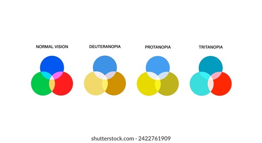 Color blindness infographic. Vision deficiency concept. Difference between colors. Deuteranomaly deuteranopia and protanomaly. Protanopia, tritanopia and tritanomaly. Achromatopsia vector illustration