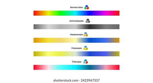 Color blindness infographic. Vision deficiency concept. Difference between colors. Deuteranomaly deuteranopia and protanomaly. Protanopia, tritanopia and tritanomaly. Achromatopsia vector illustration