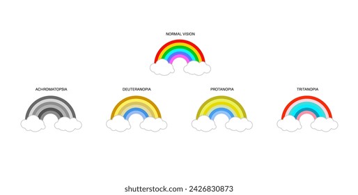 Color blindness infographic. Vision deficiency concept. Difference between colors. Deuteranomaly deuteranopia and protanomaly. Protanopia, tritanopia and tritanomaly. Achromatopsia vector illustration