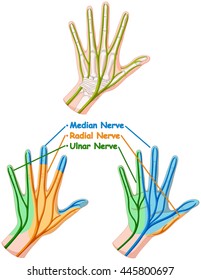 Color diagram showing hand nerve illustration