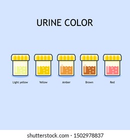 Hematuria Color Chart