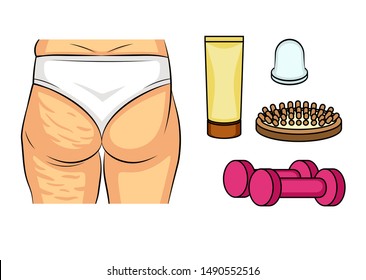 Color vector illustration before and after cellulite problems. Female hips rear view. Fat deposits on the female buttocks. Ways to combat cellulite. Infographics icons scrub, massage, fitness.
