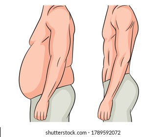 Color vector illustration isolated on white background. Man before and after losing weight. Male body transformation. The man lost extra pounds and lost weight at the waist.