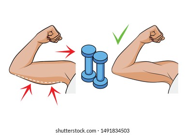 Color vector illustration of a problem of overweight in women. Female hands side view. Body fat on female triceps. Before and after dumbbell exercises