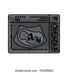 colored crayon silhouette of monitoring ultrasound of baby in device vector illustration
