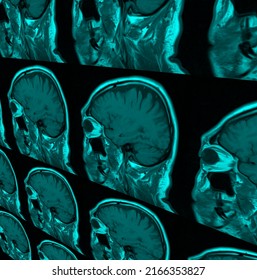 Colored sagital brain MRI vector background 