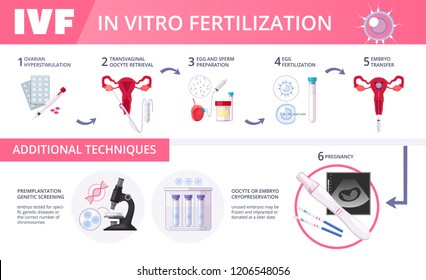 Infografia plana de fertilização in vitro colorida FIV com etapas de técnicas adicionais ilustração vetorial