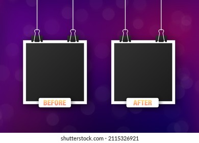 Colorful before and after frames. Vector illustration. Vector template. Design template.