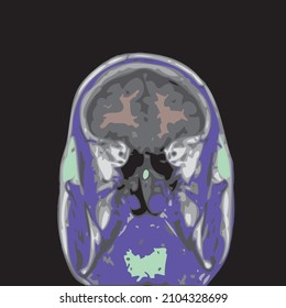 colorful mri of the brain of an adult male on a black background 