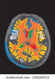 colorful mri of the brain of an adult male on a black background