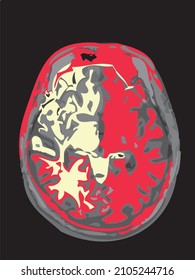 colorful mri of the brain of an adult male on a black background