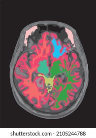 colorful mri of the brain of an adult male on a black background
