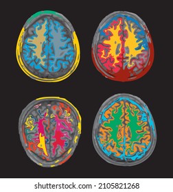 colorful MRI set of the brain of an adult male on a black background