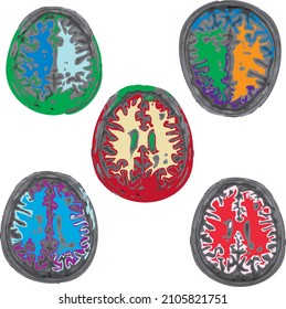 colorful MRI set of the brain of an adult male on a white background