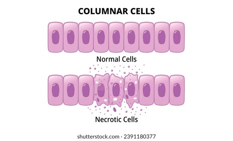 Columnar Cells - Normal Epithelial Cell - Necrotic Cell - Medical Vector Illustration