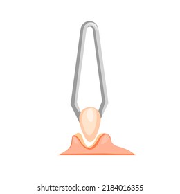 Comedo removal using tweezers illustration vector