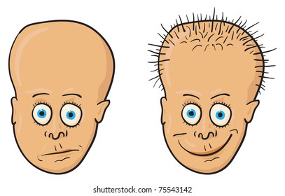 Comic vector illustration - A patient with a bald head and growing hair