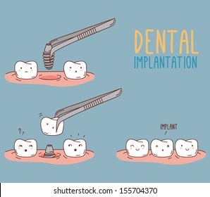 Comics about tooth replacement. Vector illustration for children dentistry and orthodontics. Cute characters. Dental implantation, care and treatment.