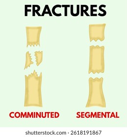 comminuted segmental fracture different types of fracture design illustration