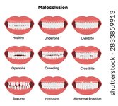Common dental and orthodontic problems, including underbite, overbite, open bite, crowding, crossbite, spacing, protrusion, and abnormal tooth eruption
