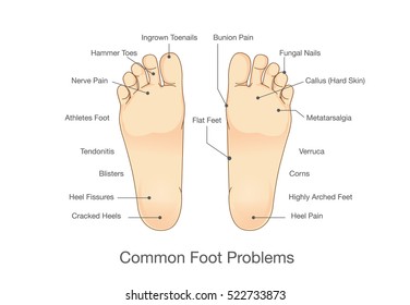 Foot diagram Images, Stock Photos & |