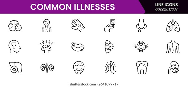 Common Illnesses line icons set. Common Illnesses outline icons with editable stroke collection. These Includes Breast Cancer, Depression, Brain Tumor, Allergy, Diabetes, and More.