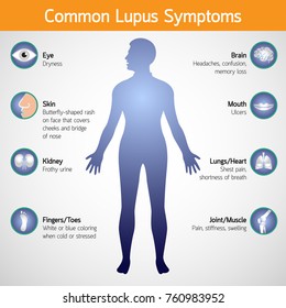 common lupus symptoms vector logo icon illustration