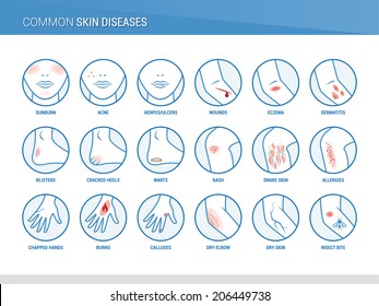 Common skin diseases