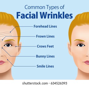 Common Types of Facial Wrinkles. cosmetic surgery. woman facial treatment concept.