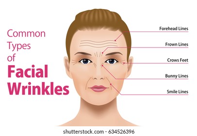 Common Types of Facial Wrinkles. cosmetic surgery. woman facial treatment concept.