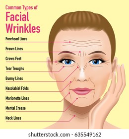 Common Types of Facial Wrinkles. cosmetic surgery. woman facial treatment concept.