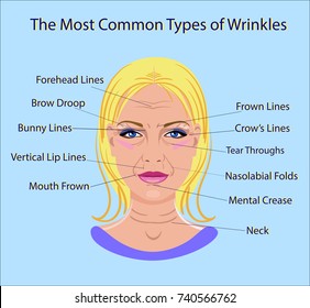 Common Types of Facial Wrinkles. cosmetic surgery. woman facial treatment isolated