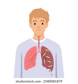 Comparation healthy lung to a damaged lung filled with cigarettes, harmful effects of smoking. Flat vector illustration isolated on white background