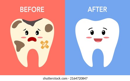 Compare teeth before and after cleaning in flat design. Dental health care.
