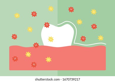 Vergleichen Sie den Zahn zwischen Schutzbakterien, Mikroben oder Viren um die Zähne - Vektorillustration mit Zahnkarikaturen im flachen Stil für Design