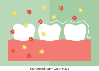 Compare tooth between by protection and not protection bacteria, microbe or virus around teeth - dental cartoon vector flat style cute character for design