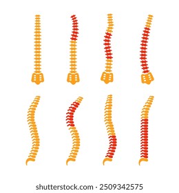 Comparando diferentes formas da coluna vertebral humana com postura correta e incorreta, destacando áreas de dor nas costas