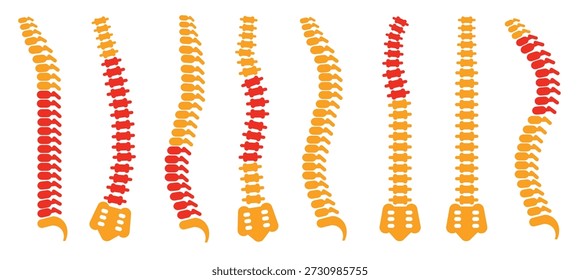 Comparación de diferentes Formas de la columna vertebral humana con la correcta